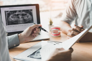 Crown vs. Veneer: Key Differences and How to Choose