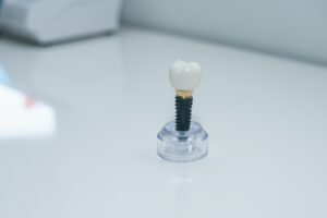 How Frequently Should You Visit Your Dentist for Optimal Oral Health?